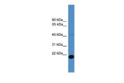 TMEM166 Rabbit anti-Human, Polyclonal, Novus Biologicals 0.1ml; Unconjugated:Antibodies,